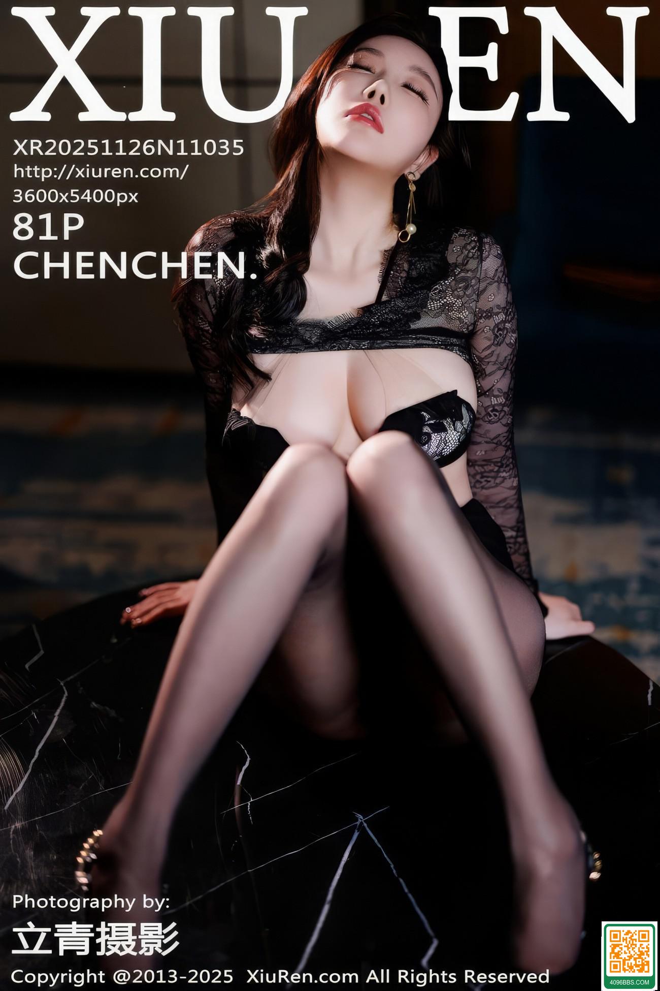 【XIUREN秀人網】2025.11.26 Vol.11035 CHENCHEN. 楊晨晨 完整版無水印寫真【81P】